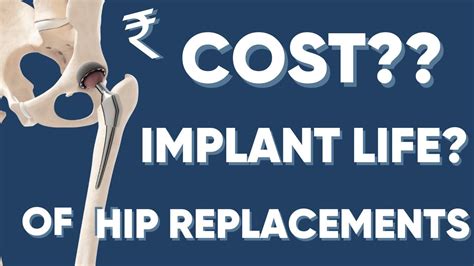 hip replacement lifespan.